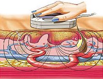 Магнитотерапия